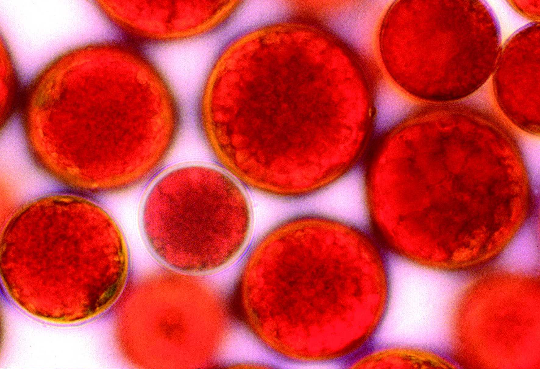 Красные водоросли клетки. Astaxanthin Haematococcus Pluvialis. Микроводоросли Гематококкус- астаксантин. Гематококкус Плувиалис. Гематококкус водоросль.